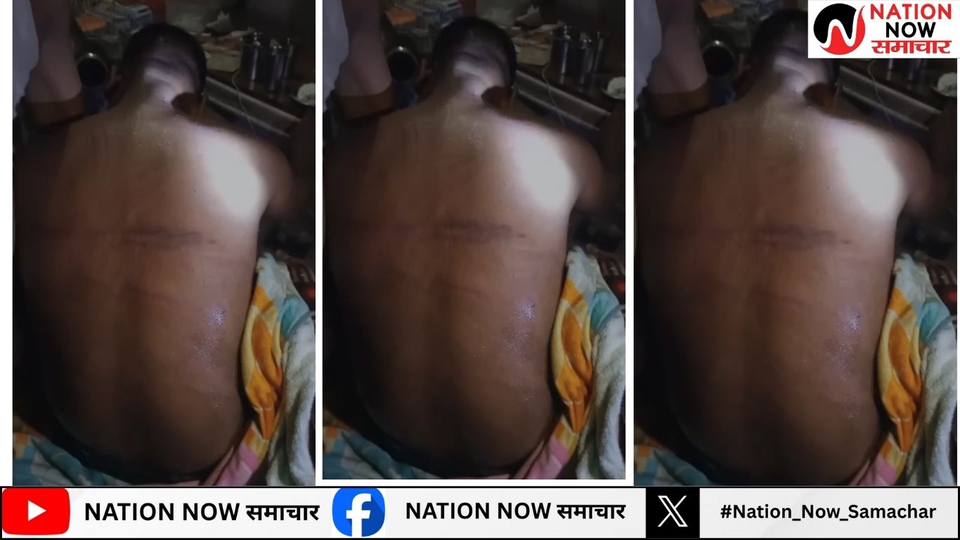 पीलीभीत: कथित भाजपा नेता की ग्रामीणों ने की पिटाई, दौड़ा-दौड़ा कर मारा